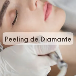 estetica facial peeling diamante